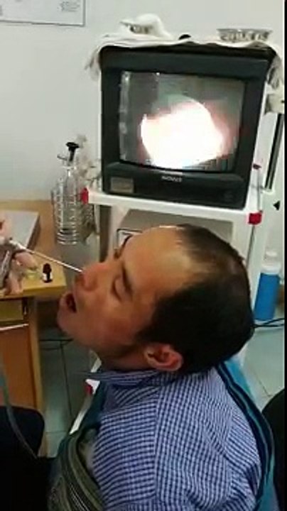 Une sangsue dans le nez d'un homme