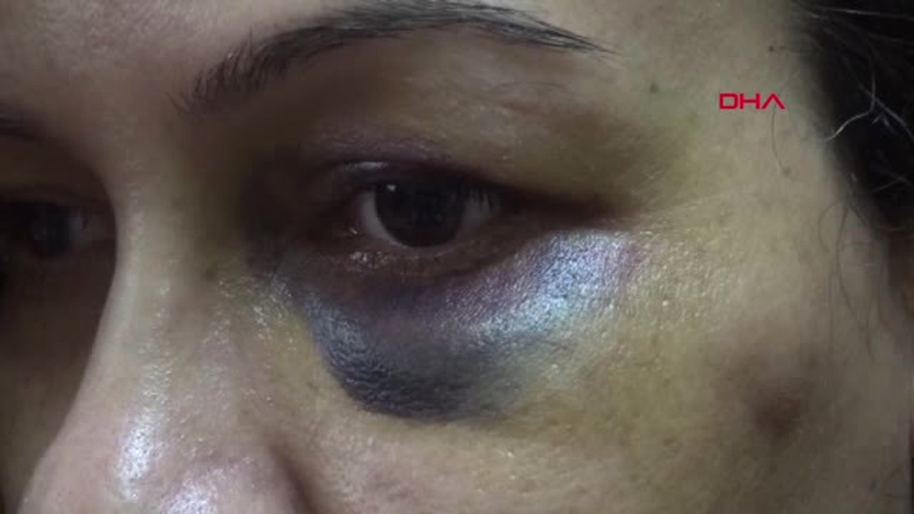 Aydın Boşanma Davası Açtı, Koruma Karar Aldırdı Yine de Şiddetten Kurtulamadı