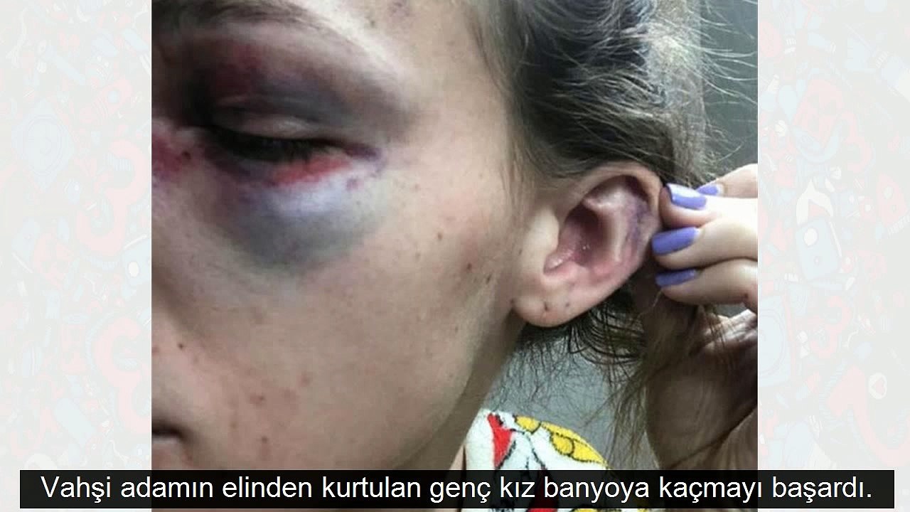 Sevgilisini 'dekolte' yüzünden vahşice dövdü