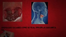 ⭐ Como curar el vph en la garganta | Tratamiento casero