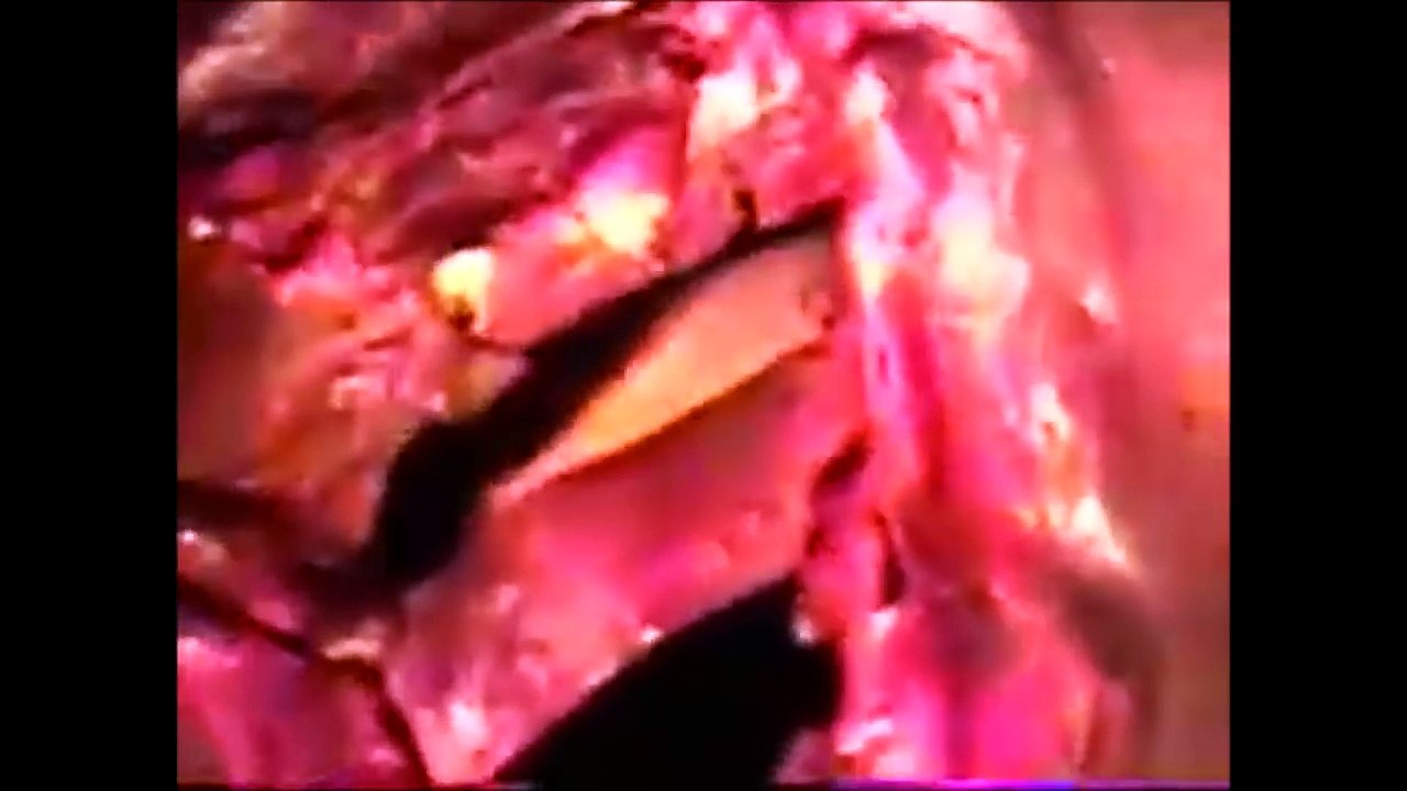 Milagro en México_ Vídeo del Corazón palpitante de Jesús