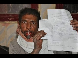 احتجاجا على إزالة الكشك الخاص بيه يغلق فمه بقفل حديدى