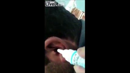 Docteur, je crois qu'il y a quelque chose dans mon oreille..