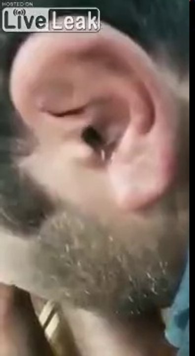 1 mille pattes sort de son oreille !!