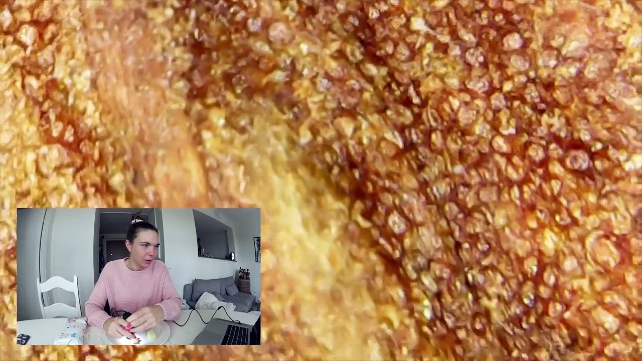 MAT UNDER MIKROSKOP ° OMG SÅ HÅRIG!!!