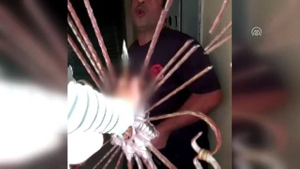 Eli Korkuluğa Saplanan Çocuk Kurtarıldı