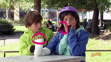 BROKEN ARM Prank