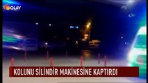 Kolunu silindir makinesine kaptırdı