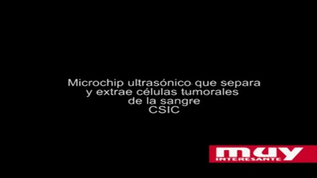 Un microchip ultrasónico separa y extrae células tumorales de la sangre