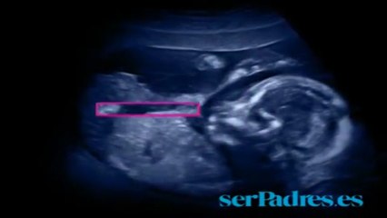 Vídeo. El bebé en el vientre materno. Semanas 17-20