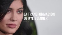 La transformación de Kylie Jenner