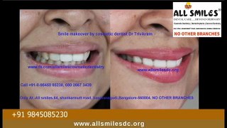 Smile Makeover in Bangalore(Before and After) | Best Cosmetic Dentist in India