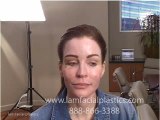 CORRECTIVE PLASTIC SURGERY WITH FAT GRAFTING DALLAS TEXAS