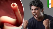 Cacing parasit dikeluarkan dari mata pria India - TomoNews
