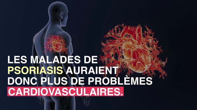 Le psoriasis serait lié à un risque plus élevé de maladies cardiovasculaires