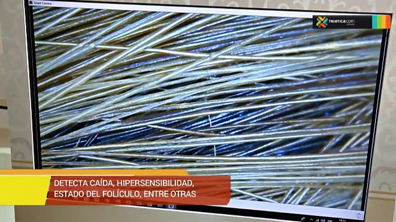 bd-conocer-salud-cabello-171018