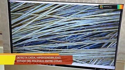 bd-conocer-salud-cabello-171018