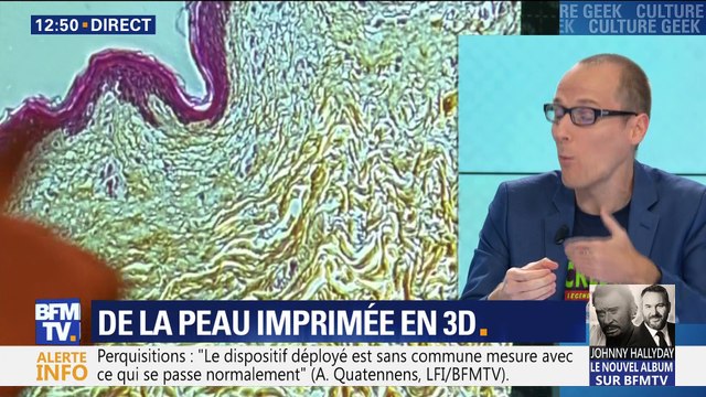 De la peau imprimée en 3D