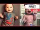Baby smiles for first time after undergoing surgery to rebuild mouth | SWNS TV