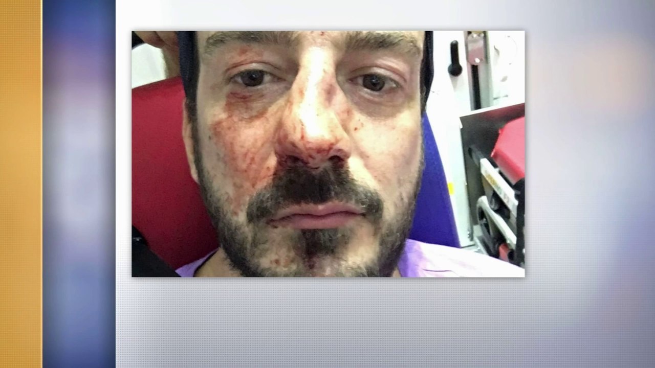 "Je suis tombé, j'ai vu mon nez explosé." Le président d'Urgence Homophobie témoigne de son agression cette semaine cette semaine