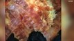 'Bugs, Bugs, Bugs': Woman Finds Worms & Dead Flies in Dunkin' Donuts Breakfast Sandwich