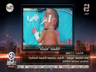"ذهبت للعلاج من الصفراء وخرجت محروقة".. والد "مليكة" يروي تفاصيل وفاتها