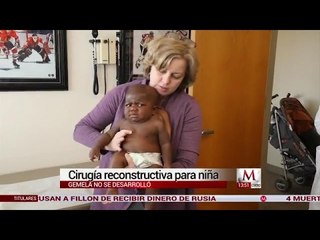 Cirugía reconstructiva para niña