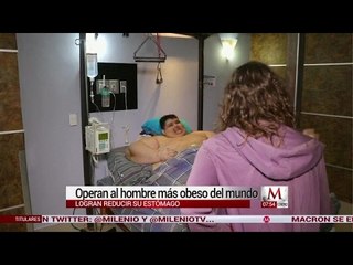 Operan al hombre más obeso del mundo