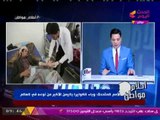 الكشف عن تفاصيل مأساة خطيرة في اليمن بسبب وباء 