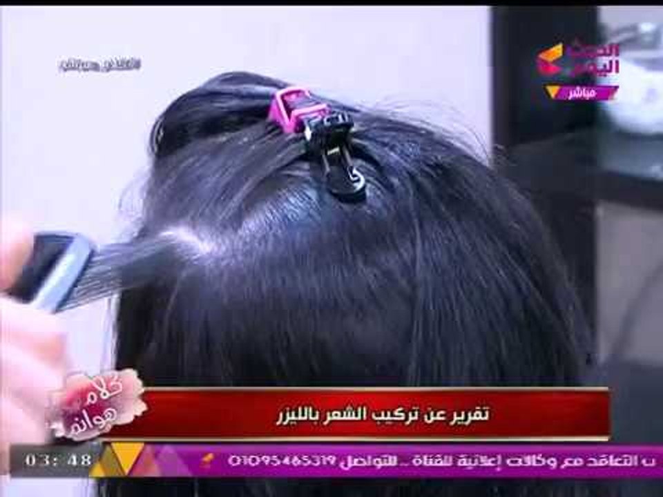 "كلام هوانم" مع "عبير الشيخ" | "تركيب الشعر بالليزر" مع "وليد فرج من بيوتي سنتر أحمد لطفى" 3-8-2017