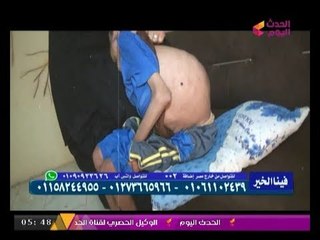 برنامج فينا الخير مع خالد الحكيم | الطفل "كريم" حالة حرجة ونادرة تنتظر العلاج (+18) 17-8-2017