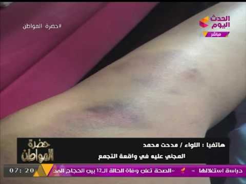 خاص| المجني عليه في واقعة التجمع يكشف تفاصيل الاعتداء عليه داخل فيلته من بلطجية "إبراهيم سليمان"