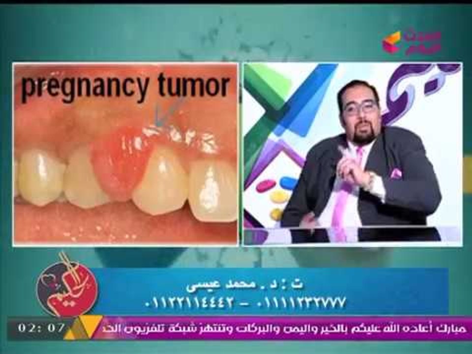 طبيب يرد على شائعات "الحموات" عن تسبب "دكتور الأسنان" في "تخلف الأطفال"!