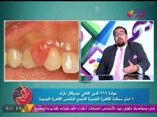طبيب أسنان مشهور يحكي أغرب حالة مرضية لسيدة حامل!