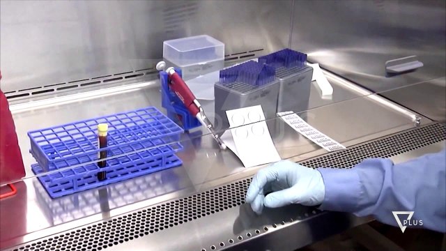 Nisin hetimet për “Check Up” - News, Lajme - Vizion Plus