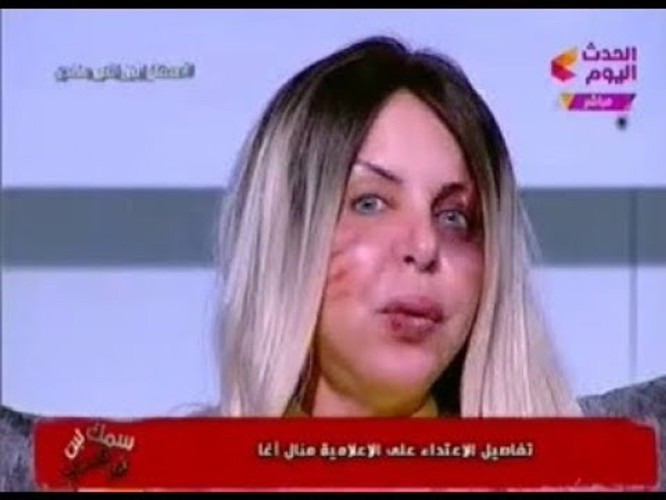 بالفيديو.. سر ظهور مذيعة "الحدث اليوم" مضروبة على الهواء