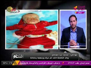 والد الطفلة المحروقة بالحضانة: مستشفي الحامول اتحولت لـ"سلخانة" واتعرض عليا رشوي مالية للصمت!!
