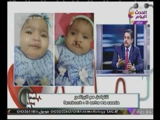 "إستشارى جراحات التجميل والعيوب الخلقية" يكشف عن سبب غير متوقع من أسباب #العيوب_الخلقية والتشوهات