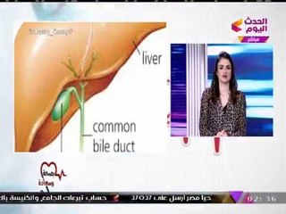 بالفيديو| أسرار الأغذية الصحية لمرضي "المرارة".... ومفاجأة يكشفها استشاري جراحة عامة