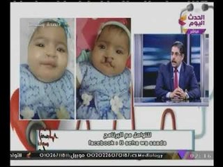 بصحة وسعادة مع ساندر نشأت وبتول علاء| لقاء مع د. وائل غانم العيوب الخلقية للاطفال 1-11-2017