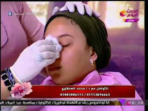 شاهد إجراء عملية تجميل لإصلاح البشرة علي الهواء، وخبير تجميل يحذر