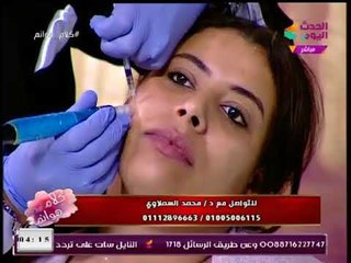 د.محمد السملاوي يجري جلسة لعلاج البشرة بالبلازما على الهواء