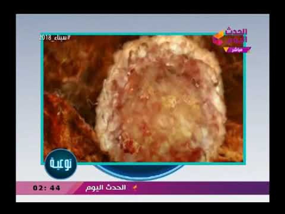 بالفيديو| د.أيمن عبد الرحمن استشاري النساء والتوليد يوضح مراحل حدوث الحمل والتبويض