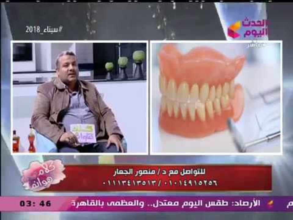 د. منصور الجعار يكشف الأسباب المختلفة لمشاكل تركيب الأسنان