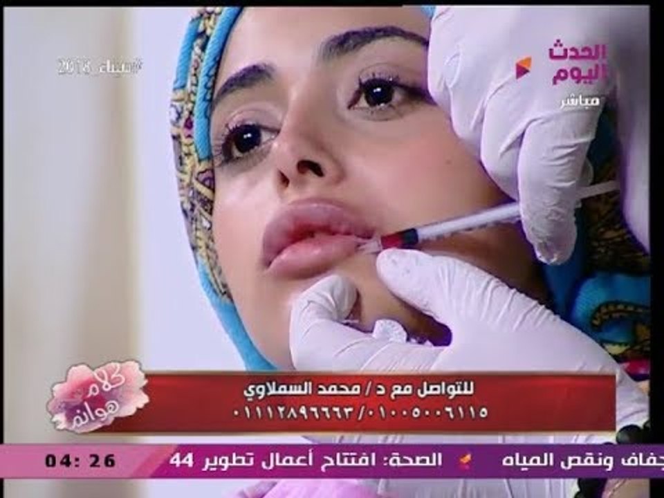 جلسة مباشرة عالهواء لحقن بلازما الشفايف مع د. م...