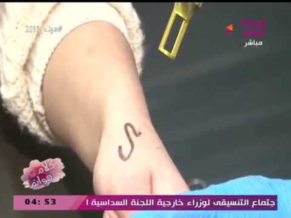 فيديو تجربة حية لإزالة التاتو بتنقية الليزر مع...
