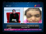 حديث الشارع مع سميحة صلاح|حالة انسانية لطفلة فقدت عينها فى حادث بالقطار 3-3-2018