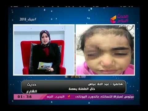 حديث الشارع مع سميحة صلاح|حالة انسانية لطفلة فقدت عينها فى حادث بالقطار 3-3-2018