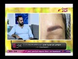 خبير التجميل طوني يوضح أحدث موضة تاتو الحواجب