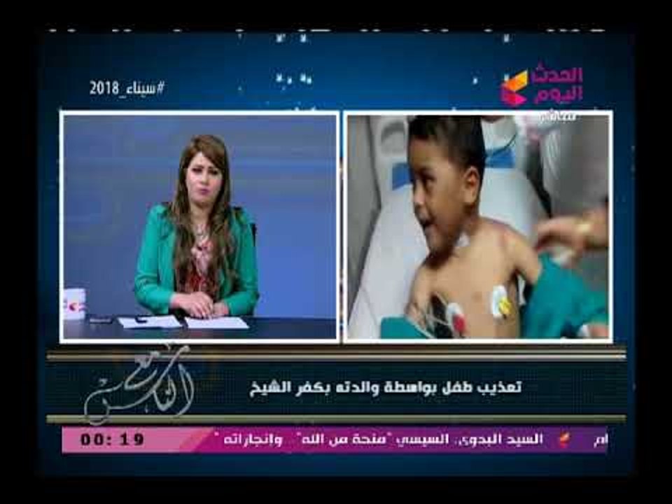 مذيعة الحدث توجه رسالة نارية لأم عذبت ابنها بطريقة وحشية وحرقته :لا يمكن يكون الولد ابن حلال!!
